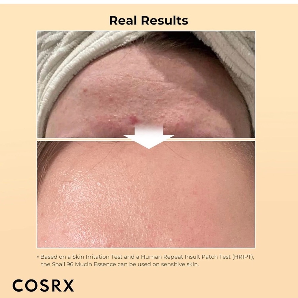 Cosrx advanced snail mucin duo - Picture 4 of 9